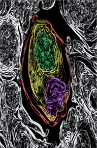 inline-graphic medsci2018343p219-img4.jpg